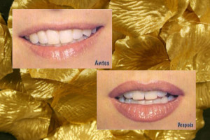 micropigmentacion labios copia